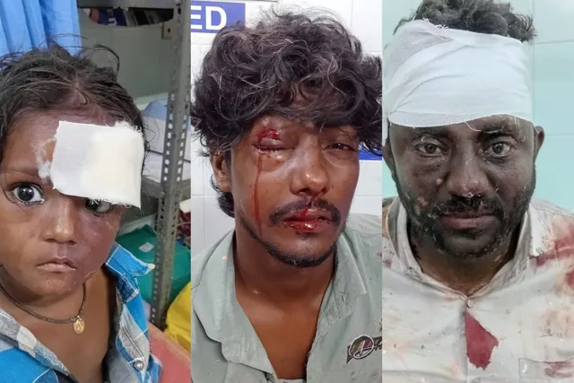 కాళీపట్నం జాతీయ రహదారిపై ద్విచక్ర వాహనాలు ఢీ, ఇద్దరికి తీవ్ర గాయాలు కాళీపట్నం జాతీయ రహదారిపై ద్విచక్ర వాహనాలు ఢీ, ఇద్దరికి తీవ్ర గాయాలు