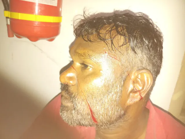 కుప్పంలో ఉద్రిక్తత..టీడీపీ కార్యకర్తపై బ్లేడ్‌లతో దాడి