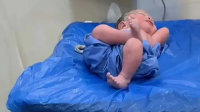 பிறந்தவுடன் கால் மேல் கால் போட்டு போஸ் கொடுத்த வைரல் குழந்தை