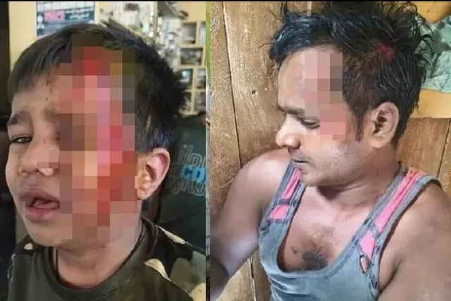 జగిత్యాల హైవేపై ఆర్టీసీ బస్సు, బైక్ ఢీ.. ఇద్దరికి తీవ్రగాయాలు జగిత్యాల హైవేపై ఆర్టీసీ బస్సు, బైక్ ఢీ.. ఇద్దరికి తీవ్రగాయాలు