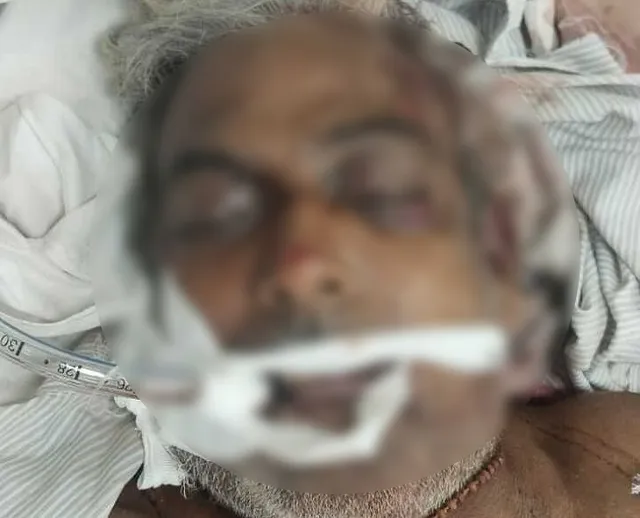 రోడ్డు దాటుతుండగా ఆర్టీసీ బస్సు ఢీ.. వ్యక్తి మృతి