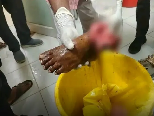బోలేరో - ఎద్దుల బండి ఢీకొన్న ఘటనలో తెగిపడిన పాదం !