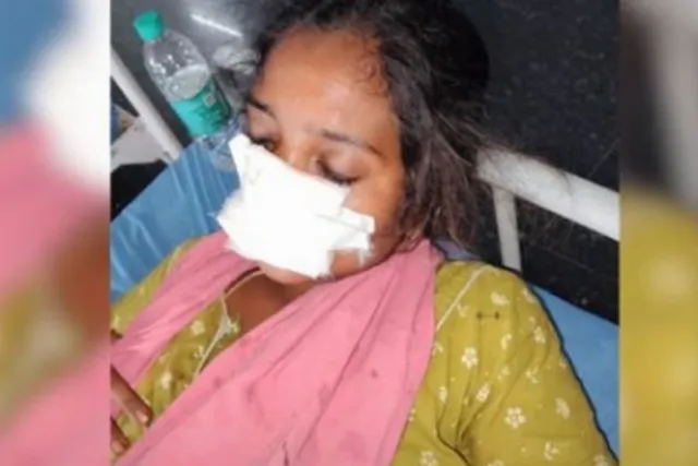 வீட்டிற்கு வர மறுத்த மனைவியின் மூக்கைக் கடித்த கணவர்