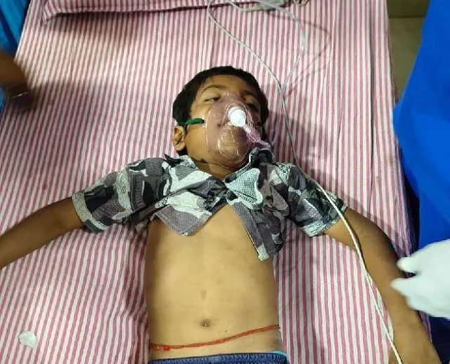 షాద్‌నగర్‌లో రోడ్డు దాటుతున్న బాలుడిని ఢీకొన్న బైక్