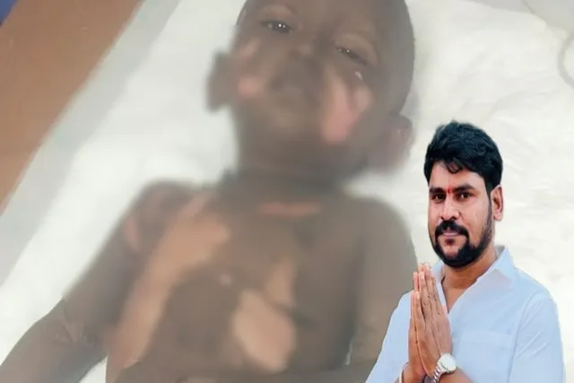 అగ్ని ప్రమాద బాధితుడికి అండగా నిలిచిన బాడీశ నాగరమేష్