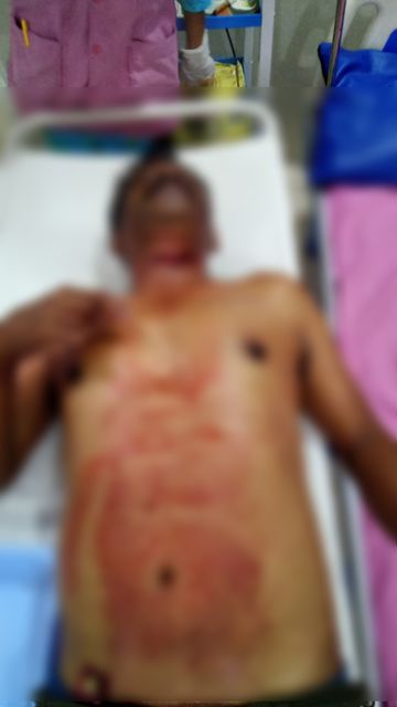 వ్యక్తి ని కాపాడిన పోలీసులు
